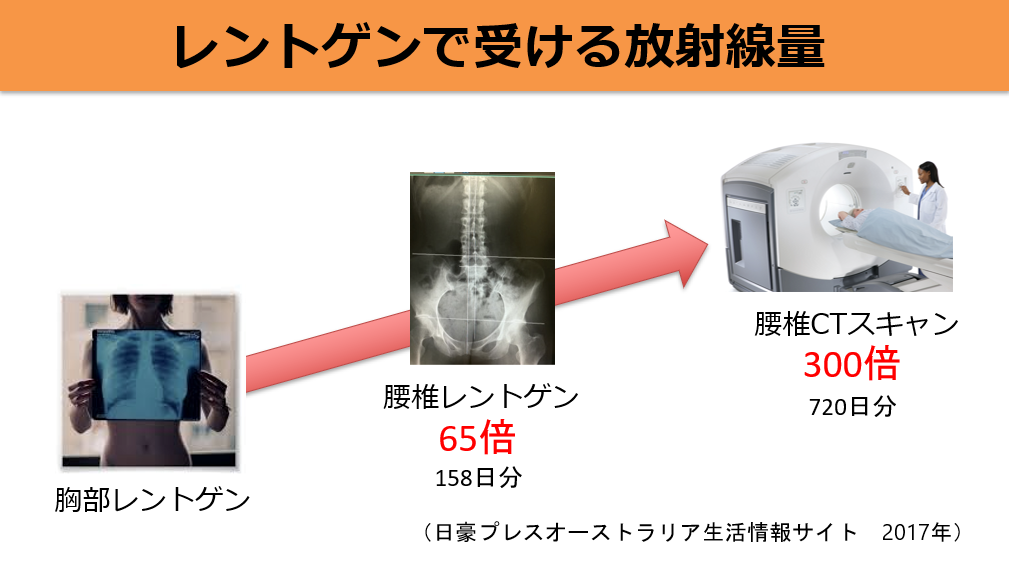 レントゲンで受ける放射線量
